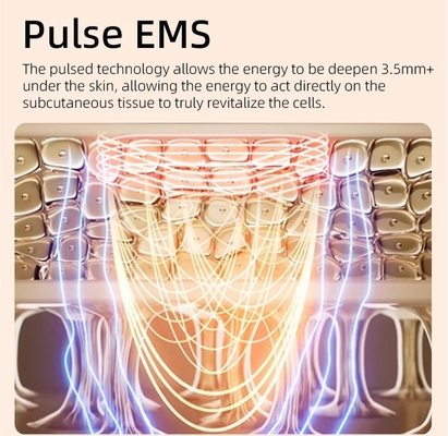 USB 충전 안구 밧줄 빛 치료 밧줄 Ems 진동 얼굴 마사저 안구 리프팅 46G
